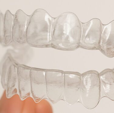Clear aligners in Brookfield, ON.