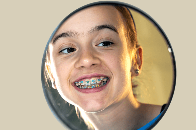 Dental-Braces