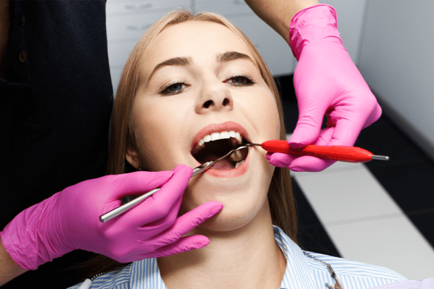 Dental-Fillings