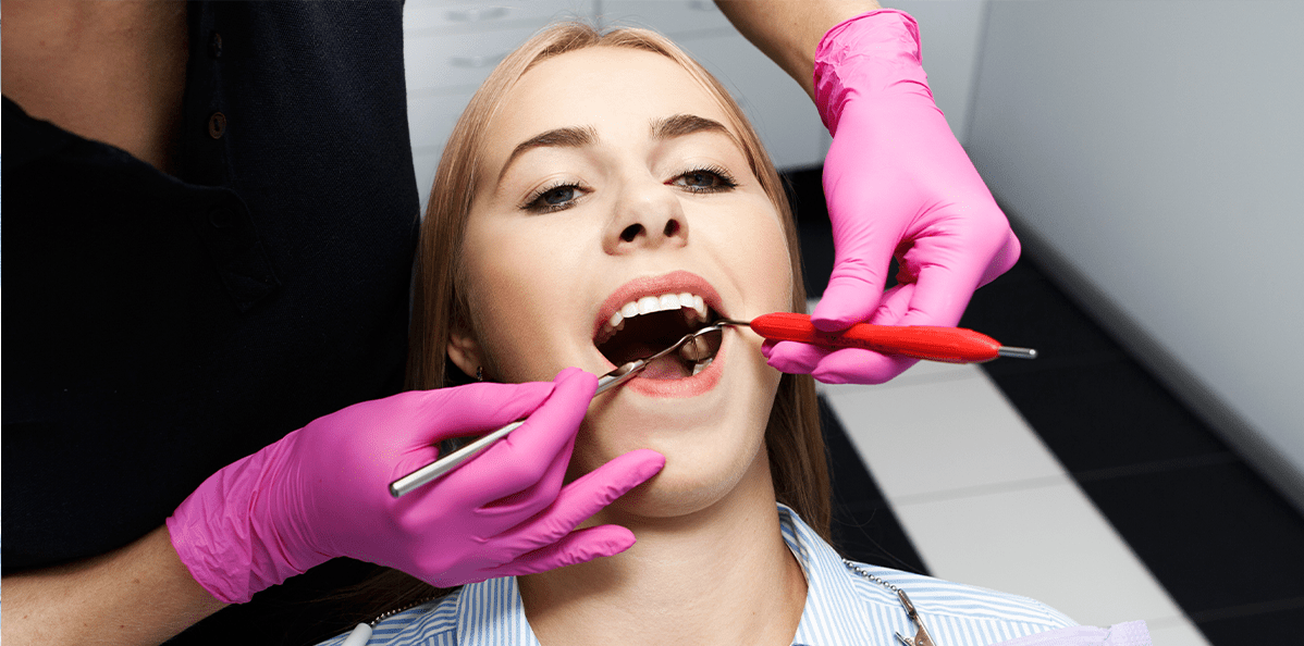 Dental-Fillings