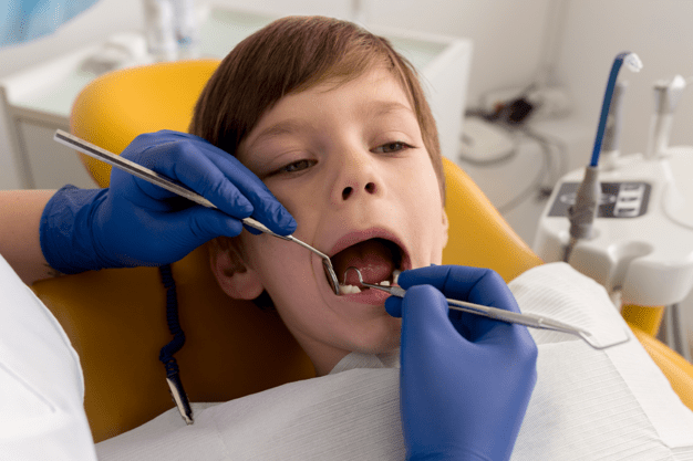 Dental-Sealants