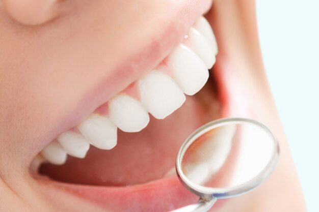 Teeth Whitening