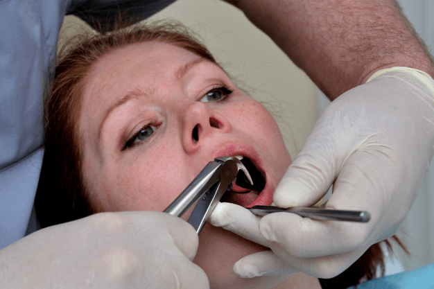 Tooth-extraction