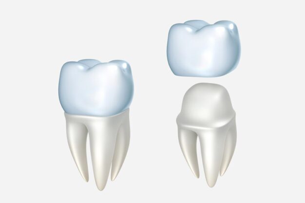 Dental Crowns
